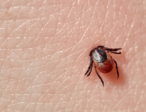 Quelle est la conduite à tenir en cas de morsure de tique et de survenue de signes d’infection ?