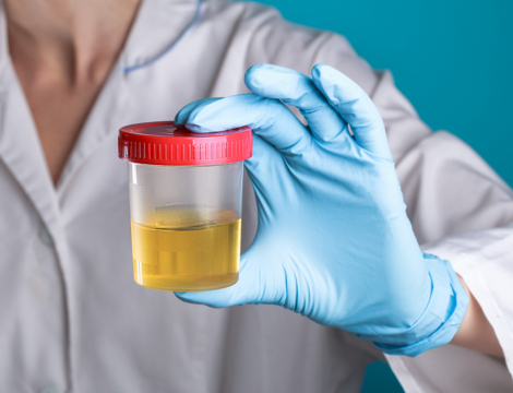 Cystites : alerte en Paca sur les prescriptions d’antibiotiques mal ciblées