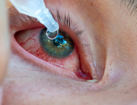 Premier recours : le dispositif Osys pourrait être généralisé dès cet été