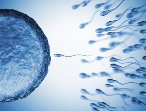 Qu’est-ce que l’autoconservation des gamètes sans motif médical ?