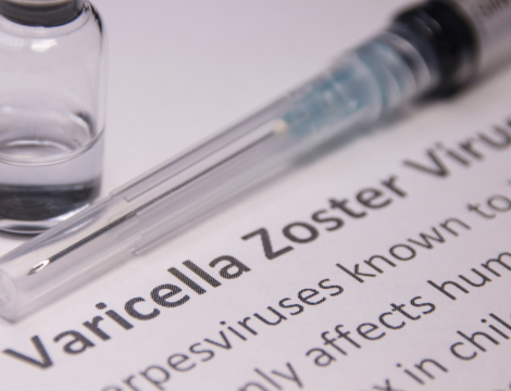 L’essentiel à retenir sur le zona