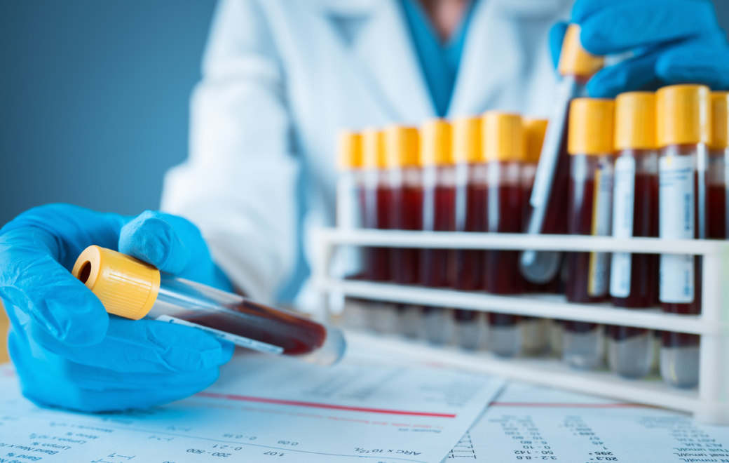 Capécitabine : une interprétation différente de l’uracilémie chez l’insuffisant rénal