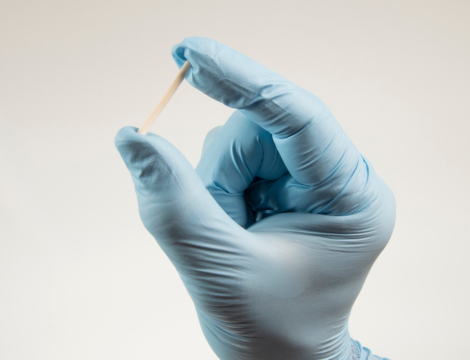 Implant Nexplanon : une prévention renforcée pour réduire encore plus le risque de migration