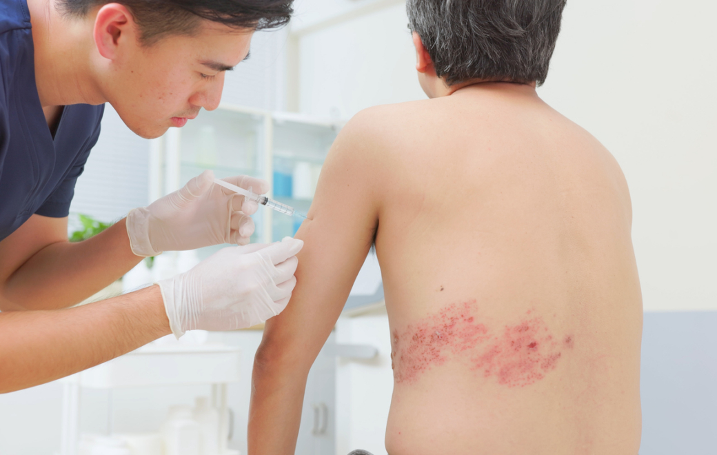 La vaccination contre le zona à l’officine