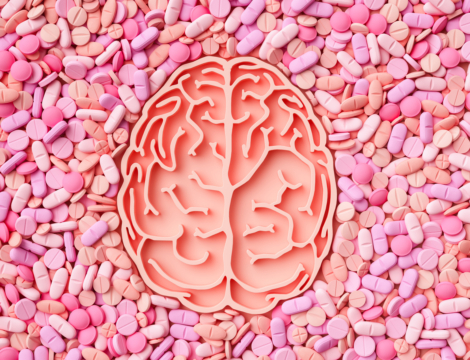 Méningiomes liés aux progestatifs : l’impact positif des mesures de réduction du risque