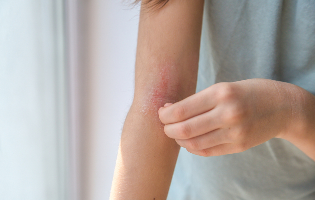 Comment se manifeste la corticophobie ?