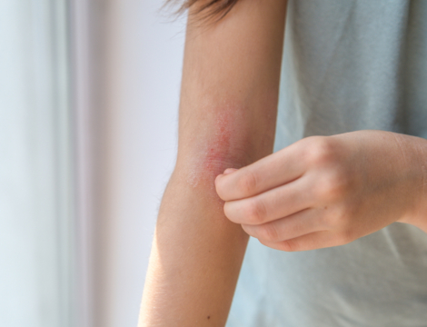 Comment se manifeste la corticophobie ?