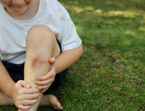 Conseils à l’officine : zoom sur les petits maux de l’été
