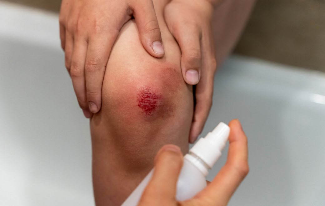 Bien conseiller un antiseptique au comptoir