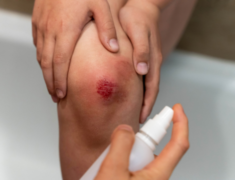 Bien conseiller un antiseptique au comptoir