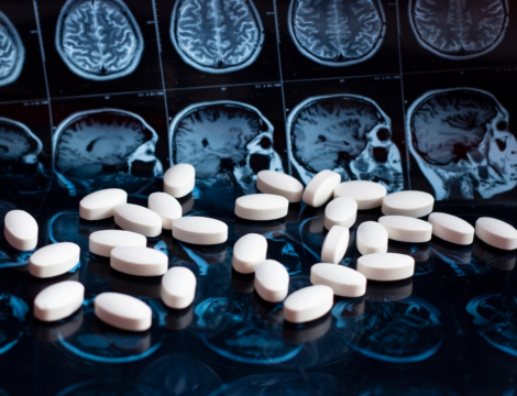 Alzheimer : l’EMA accorde une autorisation restreinte au Kisunla (donanemab) d’Eli Lilly