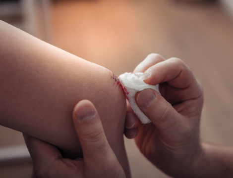 Les infirmiers vent debout contre la prise en charge des petites plaies en officine