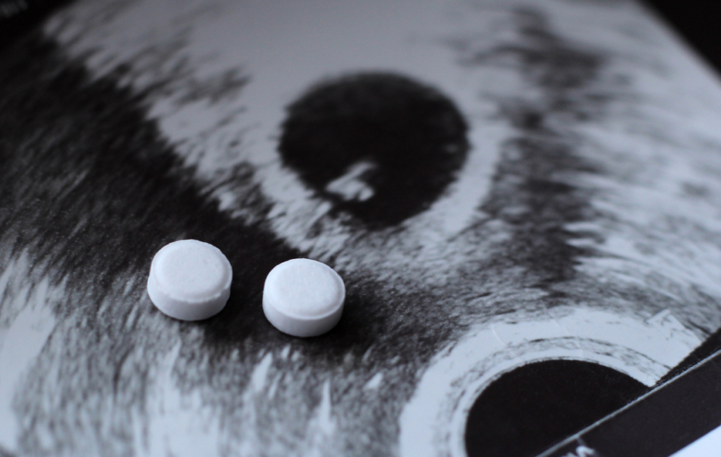 Recours à l’IVG : la Drees révèle une hausse de 3 % en 2024