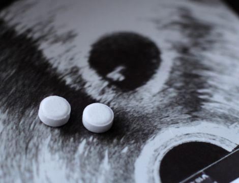 Recours à l’IVG : la Drees révèle une hausse de 3 % en 2024