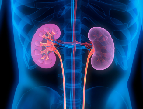 Restriction d’utilisation pour Rapamune solution buvable