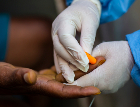 AME : le gouvernement prépare un tour de vis sur les soins remboursés