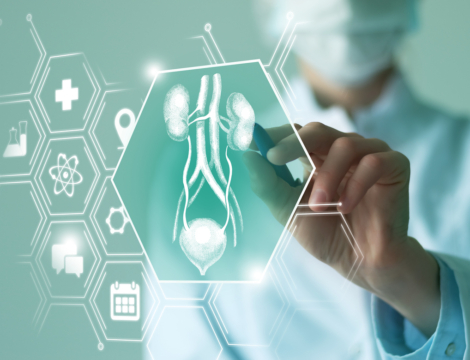 Cancer de la vessie : 5 points clés sur Balversa