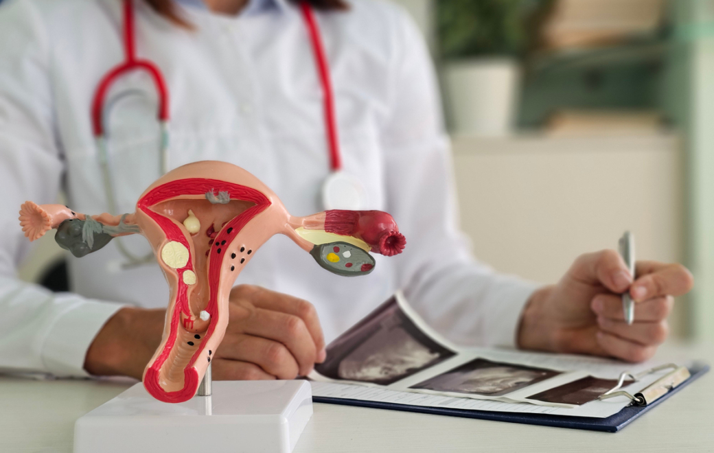 7/11 – Follitropine alfa : fiche pratique d’aide à la substitution