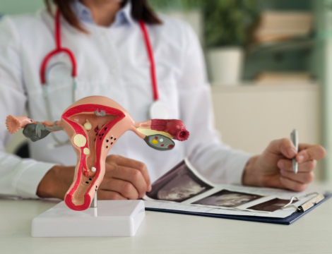 7/11 – Follitropine alfa : fiche pratique d’aide à la substitution