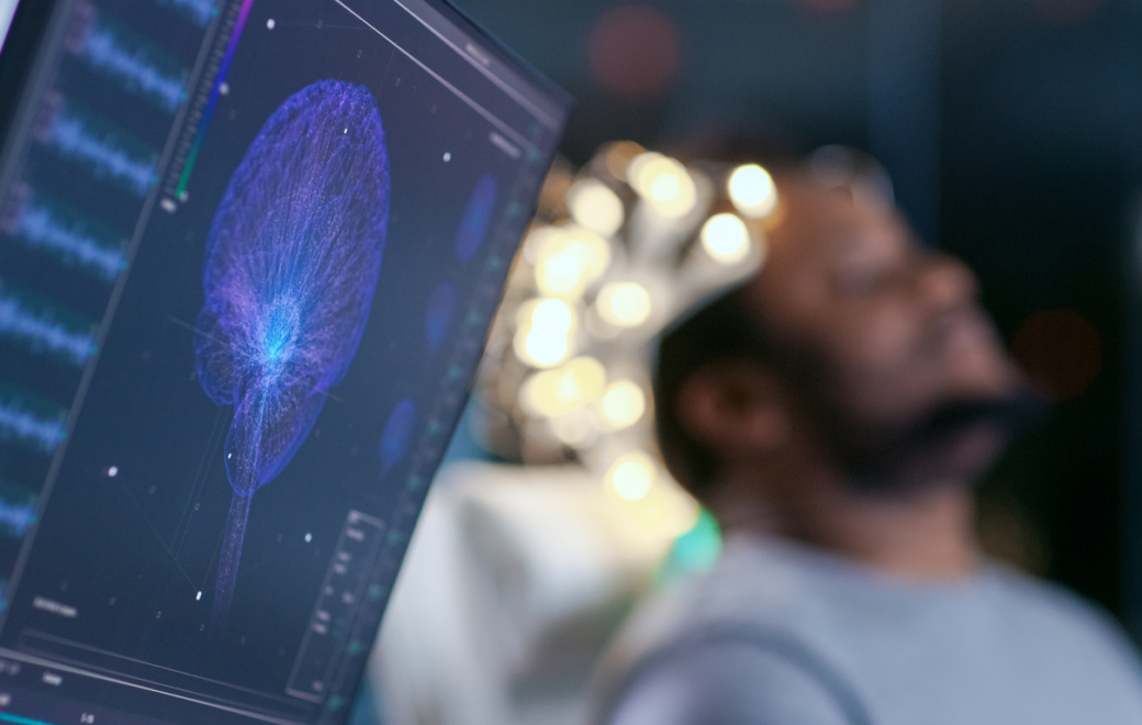 Maladie d’Alzheimer : Leqembi, le grand espoir qui fait flop