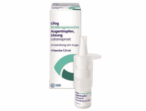 Pression intraoculaire : 5 points clés sur Lifog