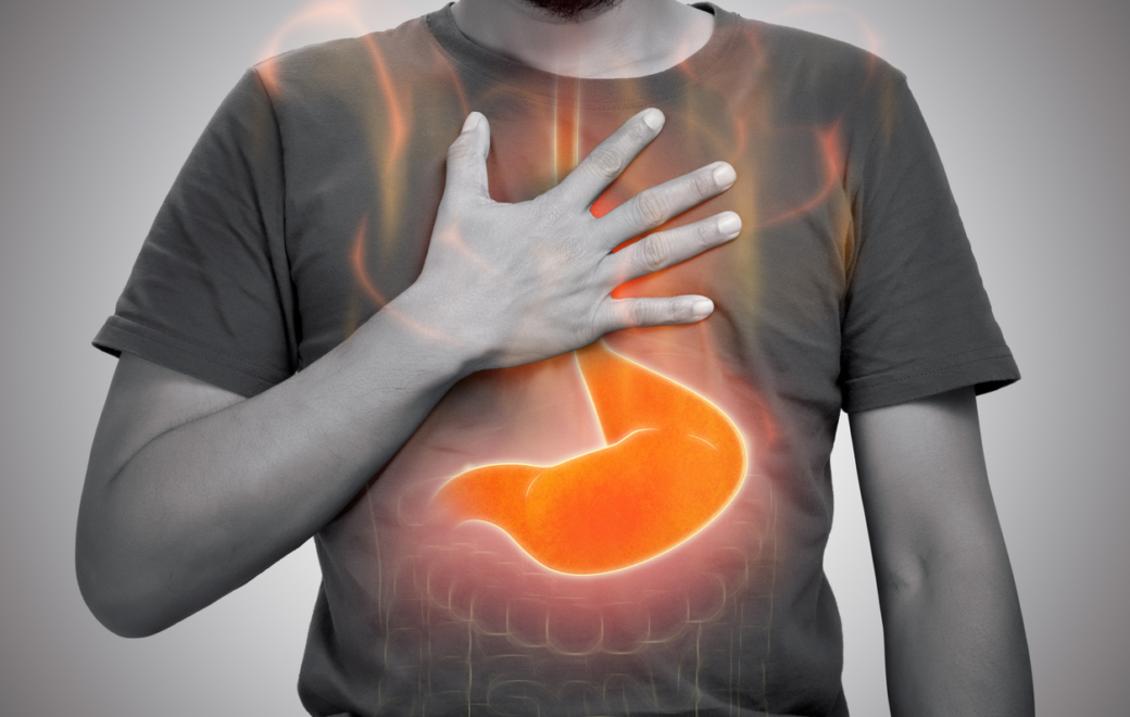 4/5 – Conseils associés : Accompagner le patient atteint de RGO