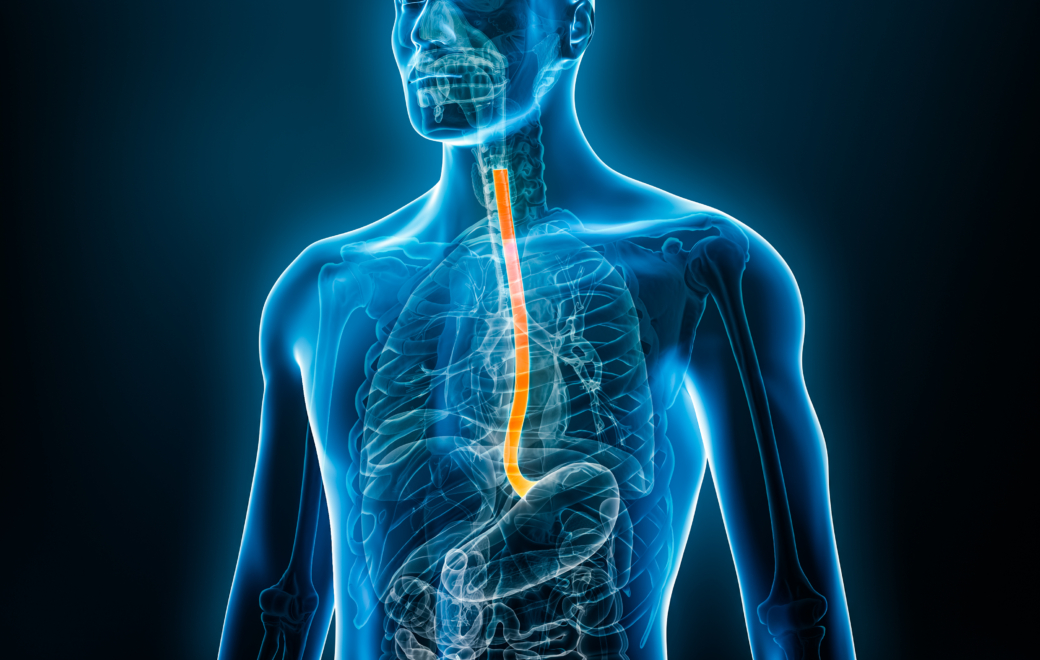 1/5 – Pathologie : le reflux gastro-œsophagien en 5 questions