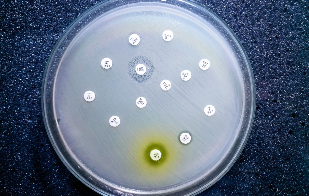 L’OMS alerte sur une résistance mondiale croissante aux antibiotiques