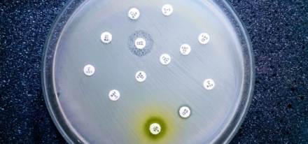 L’OMS alerte sur une résistance mondiale croissante aux antibiotiques