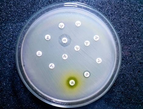 L’OMS alerte sur une résistance mondiale croissante aux antibiotiques