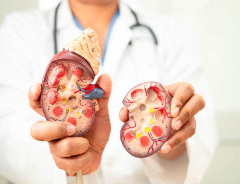 1/5 – Pathologie : la maladie rénale chronique en 5 questions