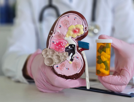 2/5 – Thérapeutique : les traitements de la maladie rénale chronique