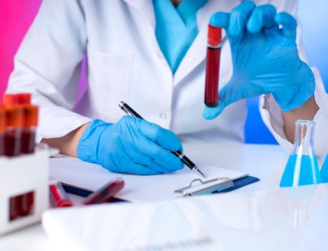 Analyse biologique : la vitesse de sédimentation est dépassée