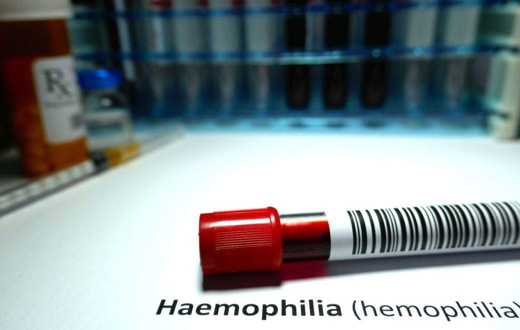 Dupixent : Sanofi renforce sa position avant l’expiration du brevet