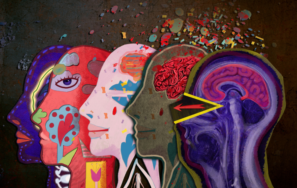 5/6 – Profils particuliers : s&rsquo;adapter aux patients sous antipsychotiques