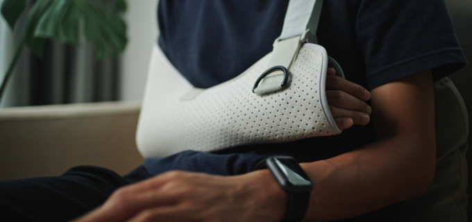 3/5 – Orthèses de l&rsquo;épaule et du coude : limiter les mouvements articulaires