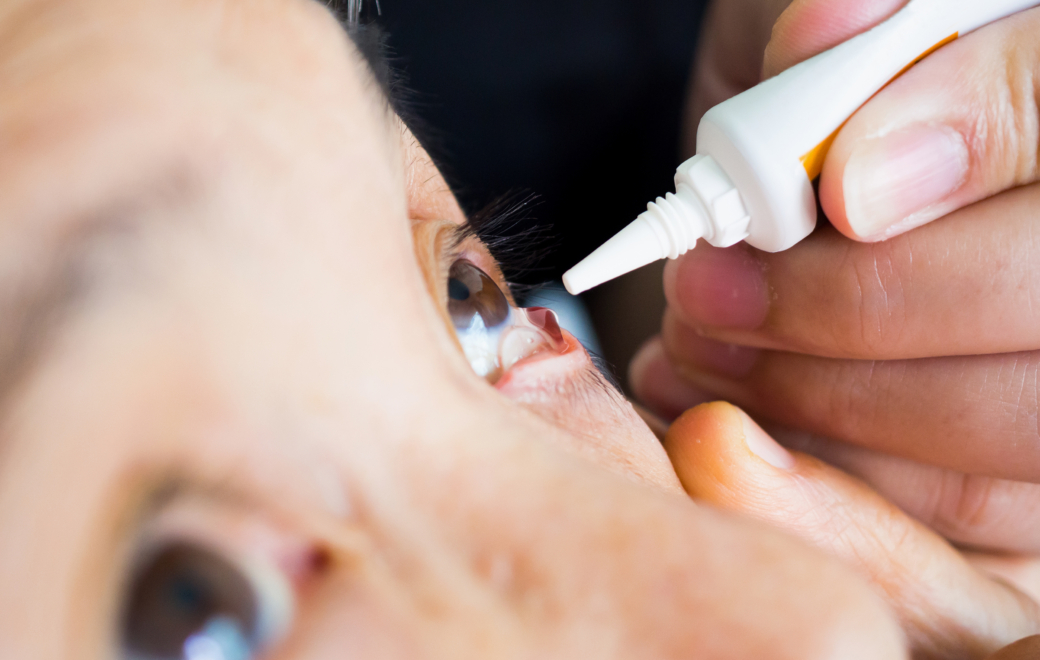 Vitamine A Dulcis : AbbVie écope d&rsquo;une sanction de 850 000 euros 